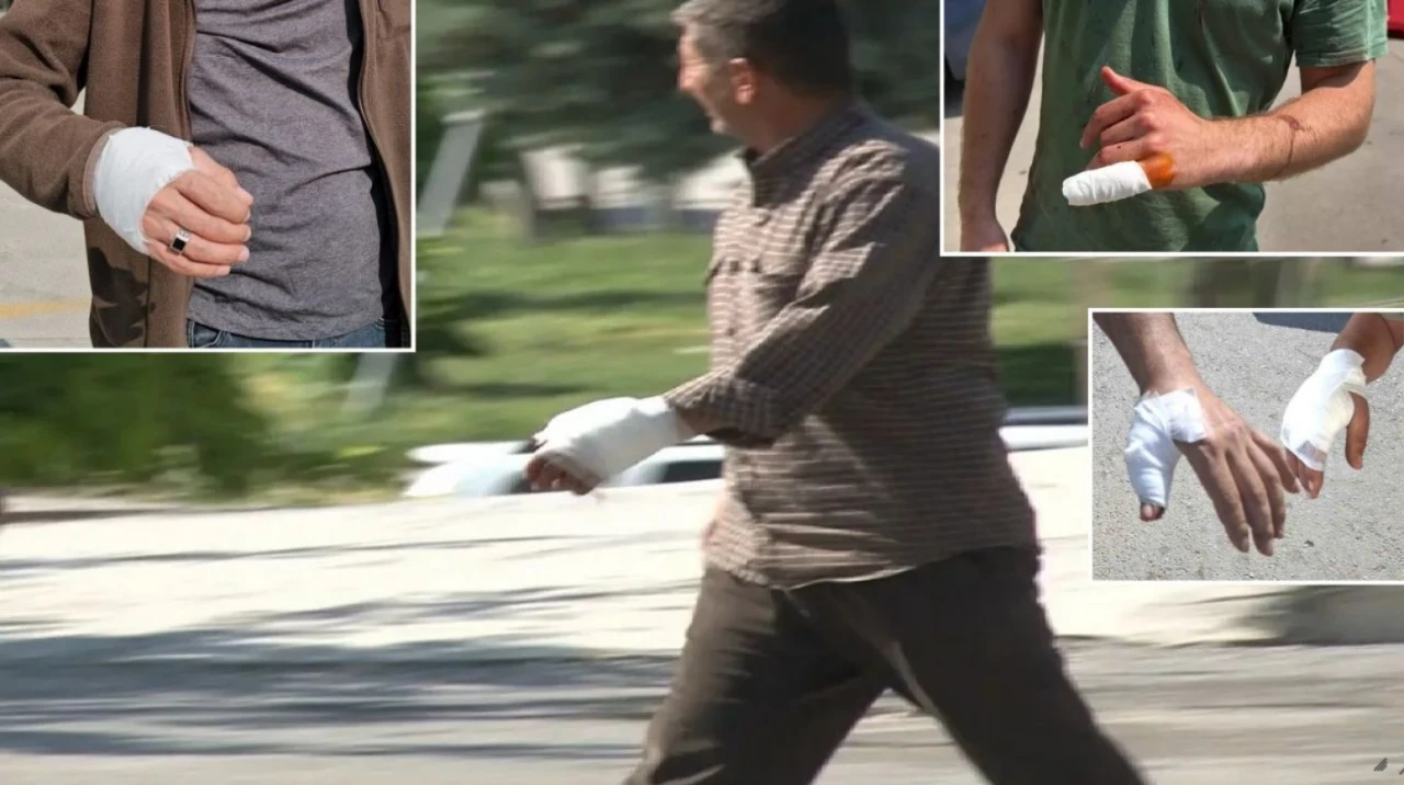 Kurban bayramının ilk gününde 14 bin 372 acemi kasap yaralandı