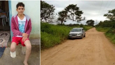 Sigortadan tazminat alabilmek için sahte saldırıyla ayağın kesti